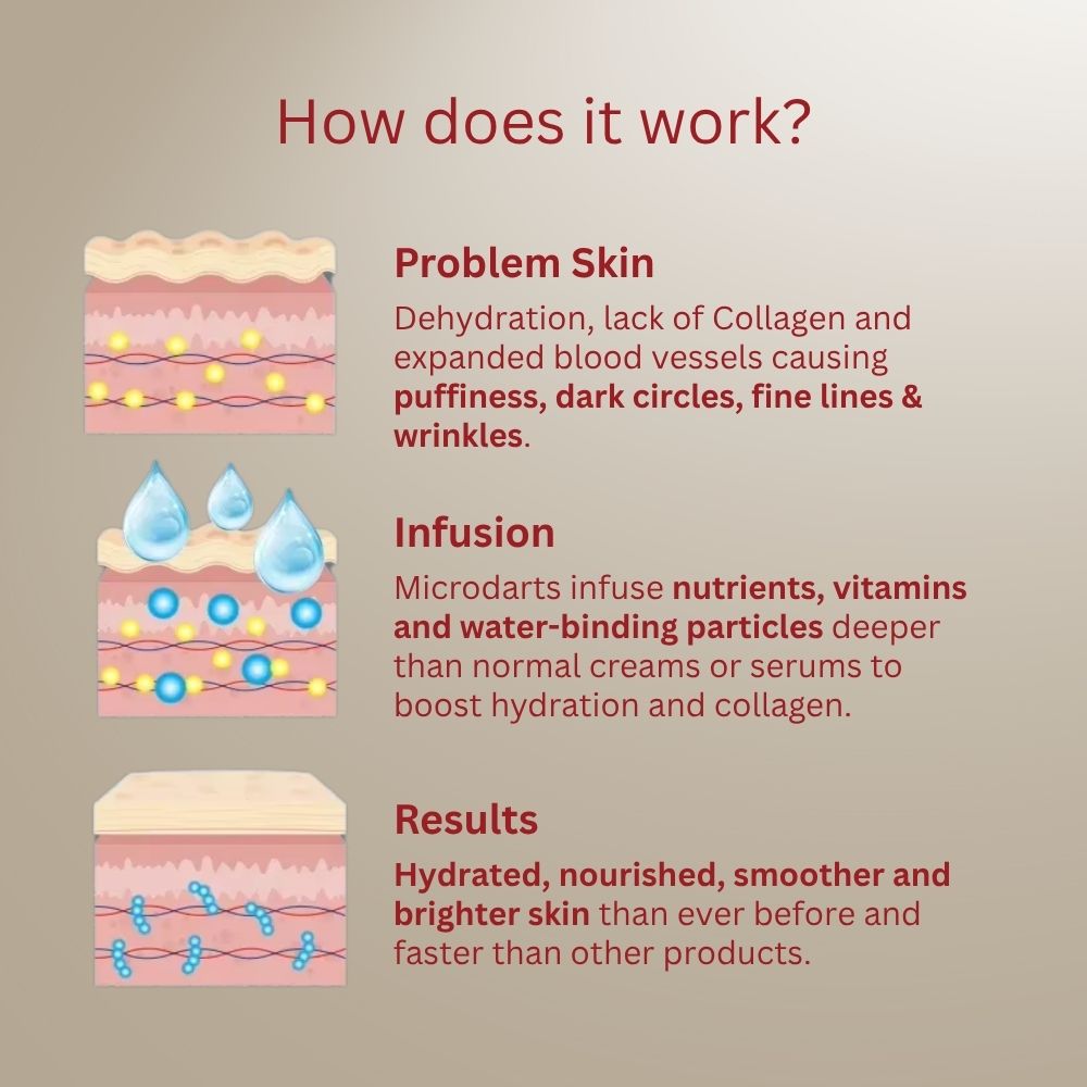 MicroInfusion Patches